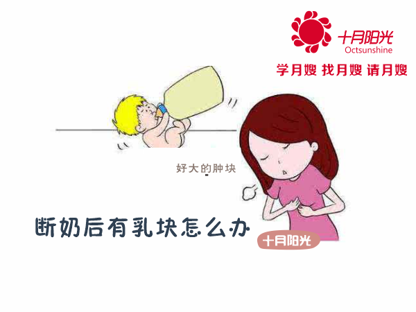 大兴催乳多少钱一次 断奶后有乳块怎么办