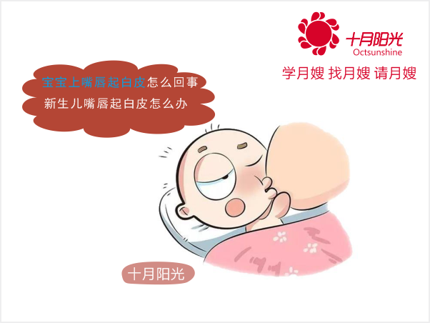 宝宝上嘴唇起白皮怎么回事 新生儿嘴唇起白皮怎么办